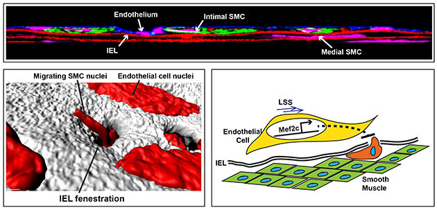 Image scan showing migrating SMC nuclei in muscle cells